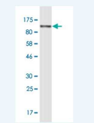 Western Blot: Alpha Actinin 4 Antibody (8G12) [H00000081-M06]