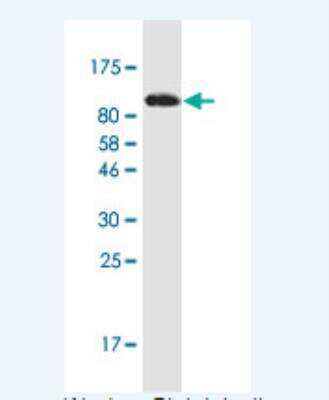 Western Blot: Alpha Actinin 4 Antibody (8G4) [H00000081-M15-100ug]