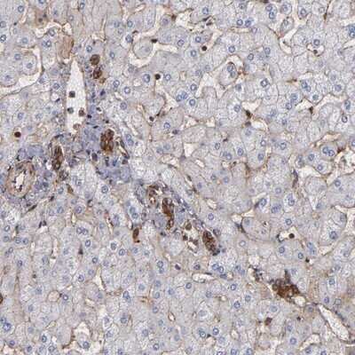 Immunohistochemistry-Paraffin: Alpha Actinin 4 Antibody [NBP1-89818]