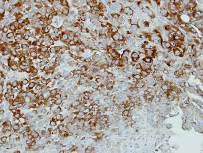 Immunohistochemistry-Paraffin: Alpha Actinin 4 Antibody [NBP2-15357]
