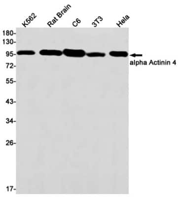 Western Blot: Alpha Actinin 4 Antibody (S06-3D7) [NBP3-14888]