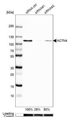 Western Blot: Alpha Actinin 4 Antibody [NBP1-89818]