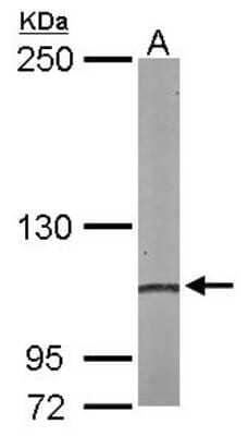 Western Blot: Alpha Actinin 4 Antibody [NBP2-15357]