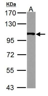Western Blot: Alpha Actinin 4 Antibody [NBP2-15357]