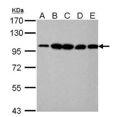 Western Blot: Alpha Actinin 4 Antibody [NBP2-15357]