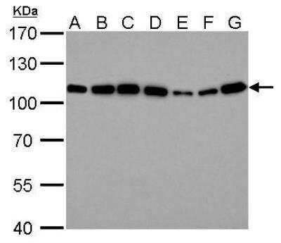 Western Blot: Alpha Actinin 4 Antibody [NBP2-15357]