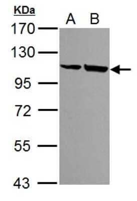 Western Blot: Alpha Actinin 4 Antibody [NBP2-15358]