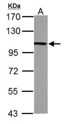 Western Blot: Alpha Actinin 4 Antibody [NBP2-15358]