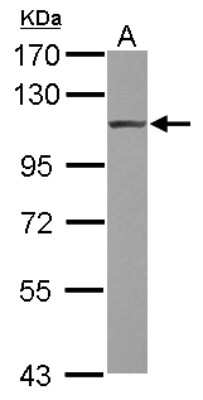 Western Blot: Alpha Actinin 4 Antibody [NBP2-15358]