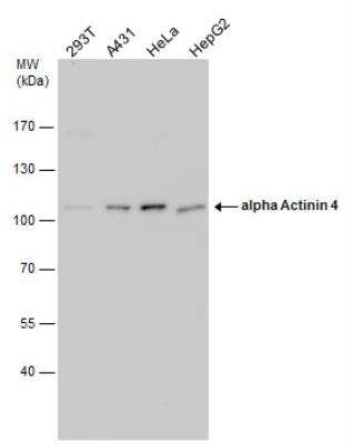 Western Blot: Alpha Actinin 4 Antibody [NBP2-15358]