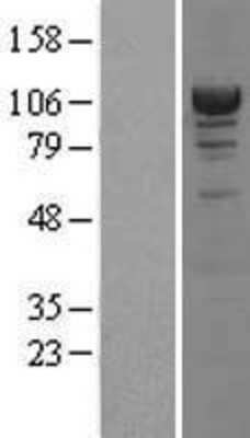 Western Blot: Alpha Actinin 4 Overexpression Lysate [NBL1-07283]