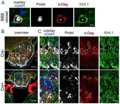 Immunohistochemistry: Alpha Dystroglycan Antibody (2238) [NBP1-49634]