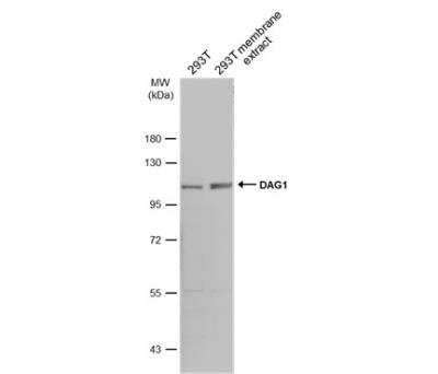 Western Blot: Dystroglycan Antibody [NBP2-14868]