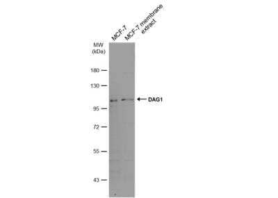 Western Blot: Dystroglycan Antibody [NBP2-14868]