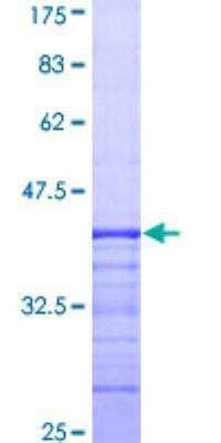 SDS-PAGE: Recombinant Human Dystroglycan GST (N-Term) Protein [H00001605-Q01]