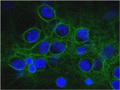 Immunocytochemistry/ Immunofluorescence: Alpha Fodrin Antibody (3D7) [NBP1-92689]