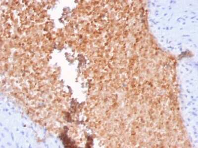 Immunohistochemistry-Paraffin: Alpha Fodrin Antibody (SPTAN1/3352) [NBP3-07267]