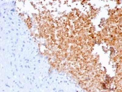 Immunohistochemistry-Paraffin: Alpha Fodrin Antibody (SPTAN1/3352) [NBP3-07267]