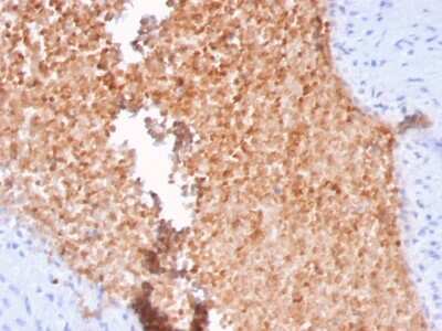 Immunohistochemistry-Paraffin: Alpha Fodrin Antibody (SPTAN1/3352) - Azide and BSA Free [NBP3-08348]