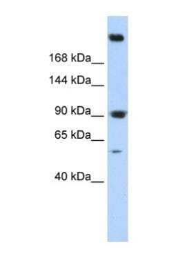 Western Blot: Alpha Fodrin Antibody [NBP1-53093]