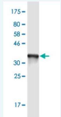 Western Blot: Alpha-TTP Antibody (7B5) [H00007274-M01-50ug]