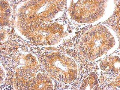 Immunohistochemistry-Paraffin: Alpha-TTP Antibody [NBP2-14870]