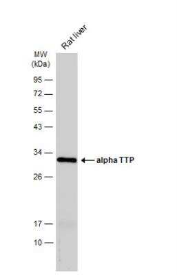 Western Blot: Alpha-TTP Antibody [NBP2-14870]