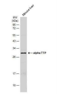 Western Blot: Alpha-TTP Antibody [NBP2-14870]