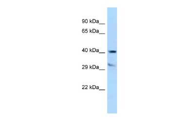 Western Blot: Alpha-TTP Antibody [NBP2-86574]