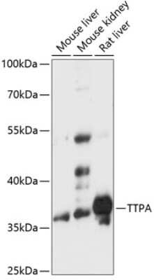 Western Blot: Alpha-TTP AntibodyAzide and BSA Free [NBP2-92170]