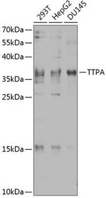 Western Blot: Alpha-TTP AntibodyBSA Free [NBP2-92559]