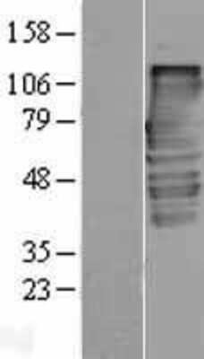 Western Blot: alpha-Taxilin Overexpression Lysate [NBP2-05052]