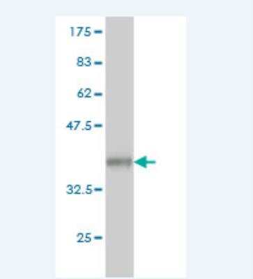 Western Blot: Alpha-mannosidase II Antibody (1G9) [H00004124-M01]