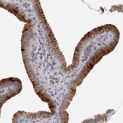 Immunohistochemistry-Paraffin: Alpha-mannosidase II Antibody [NBP1-89748]