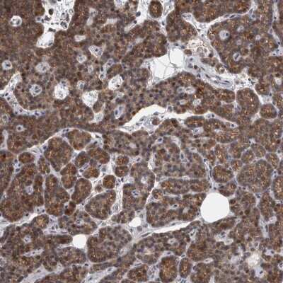Immunohistochemistry-Paraffin: Alpha-mannosidase II Antibody [NBP1-89748]