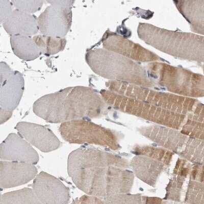 Immunohistochemistry-Paraffin: Alpha-mannosidase II Antibody [NBP1-89748]