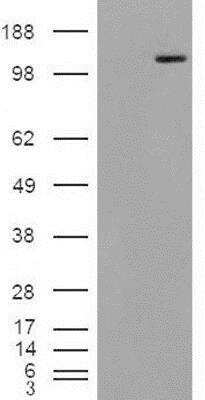 Western Blot: Alpha-mannosidase II Antibody [NB100-93414]