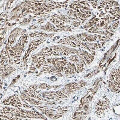 Immunohistochemistry-Paraffin: Alpha-parvin/Actopaxin Antibody [NBP1-87912]