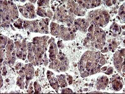 Immunohistochemistry: Alpha-parvin/Actopaxin Antibody (OTI1C10) - Azide and BSA Free [NBP2-72018]