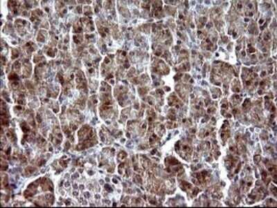 Immunohistochemistry: Alpha-parvin/Actopaxin Antibody (OTI1C10) - Azide and BSA Free [NBP2-72018]
