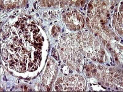 Immunohistochemistry: Alpha-parvin/Actopaxin Antibody (OTI1C10) [NBP2-46326]