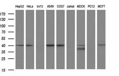 Western Blot: Alpha-parvin/Actopaxin Antibody (OTI1C10) [NBP2-46326]