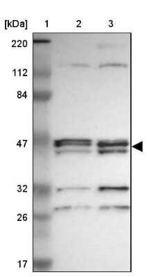 Western Blot: Alpha-parvin/Actopaxin Antibody [NBP1-87912]