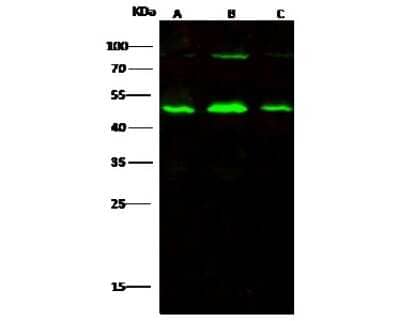 Western Blot: Alpha-parvin/Actopaxin Antibody [NBP3-00222]