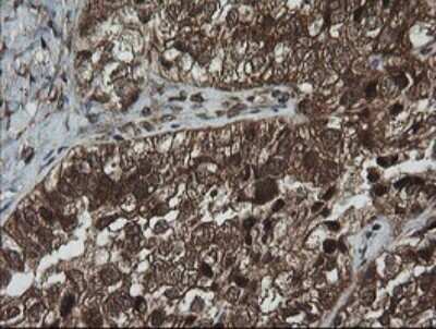 Immunohistochemistry: AlphaA Crystallin/CRYAA Antibody (OTI3B12) - Azide and BSA Free [NBP2-70450]