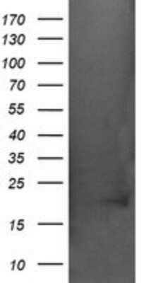 Western Blot: AlphaA Crystallin/CRYAA Antibody (OTI3B12)Azide and BSA Free [NBP2-70450]