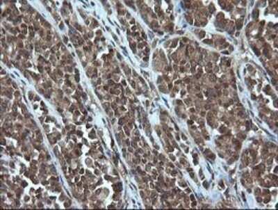 Immunohistochemistry: AlphaA Crystallin/CRYAA Antibody (OTI3B12) [NBP2-46354]