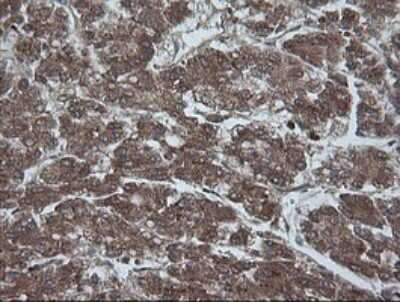 Immunohistochemistry: AlphaA Crystallin/CRYAA Antibody (OTI3B12) [NBP2-46354]