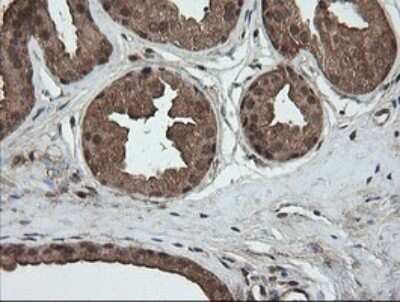 Immunohistochemistry: AlphaA Crystallin/CRYAA Antibody (OTI3B12) [NBP2-46354]