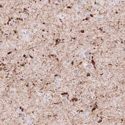 Immunohistochemistry-Paraffin: AlphaB Crystallin/CRYAB Antibody (CL10765) [NBP3-07986]